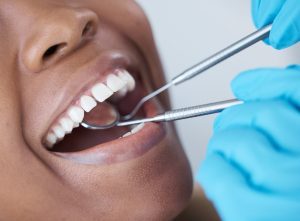 Teeth Cleaning & Checkup
